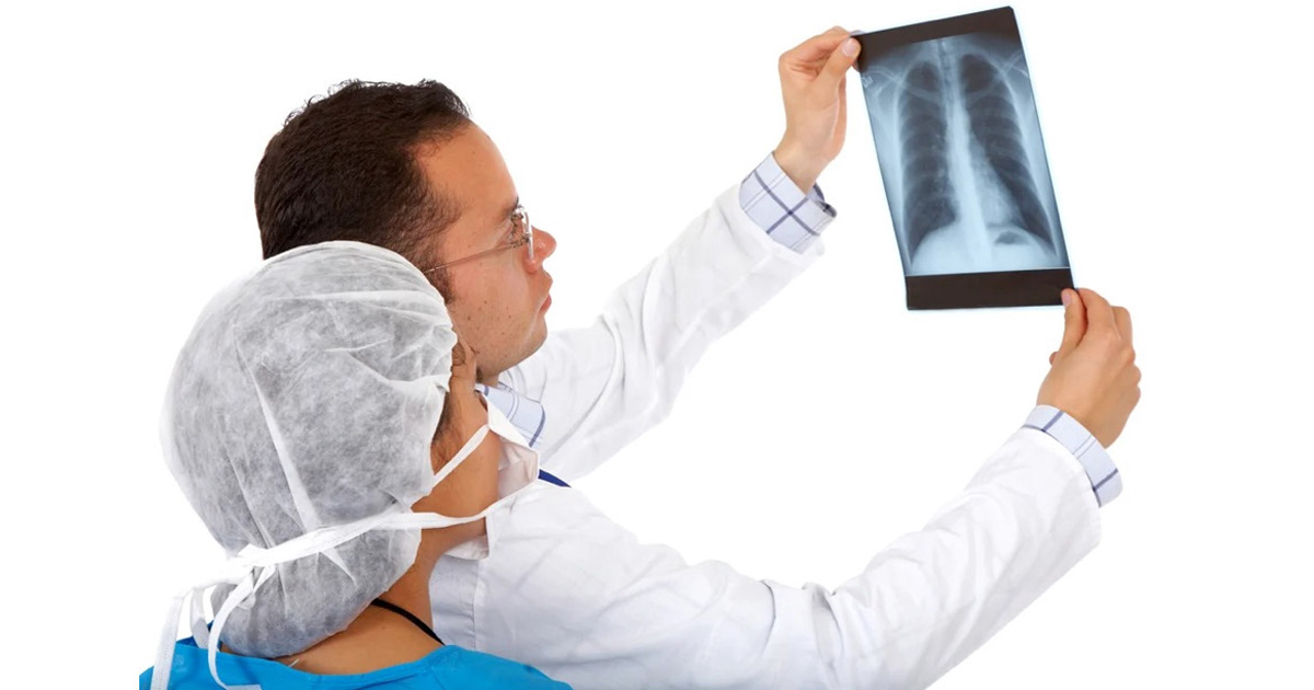 doctors-checking-a-chest-xray-is